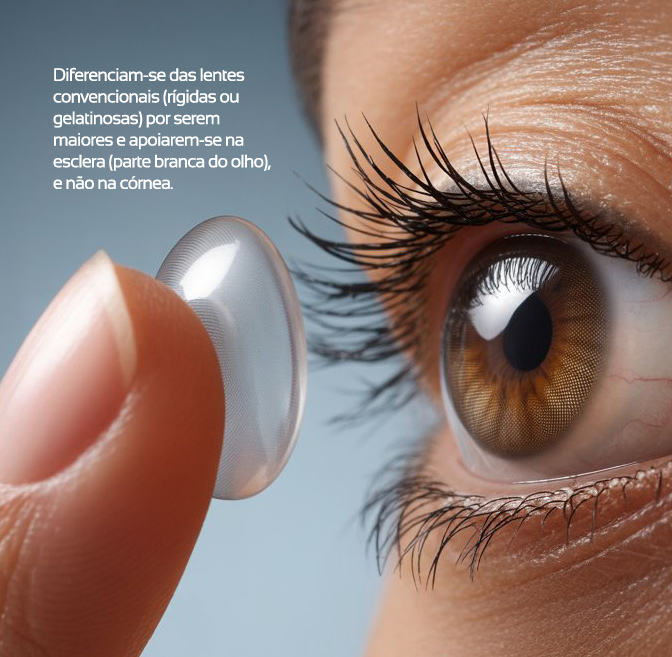 Ilustração: Transplante Penetrante